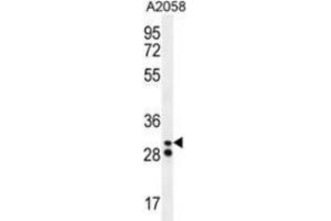 Western blot analysis in A2058 cell line lysates (35ug/lane) using Neutrophil elastase  Antibody (N-term).