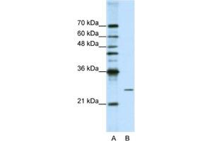 Western Blotting (WB) image for anti-Processing of Precursor 4, Ribonuclease P/MRP Subunit (POP4) antibody (ABIN2462223) (RPP29 Antikörper)