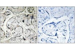 Immunohistochemistry analysis of paraffin-embedded human placenta tissue, using CYB5R3 Antibody. (CYB5R3 Antikörper  (AA 137-186))