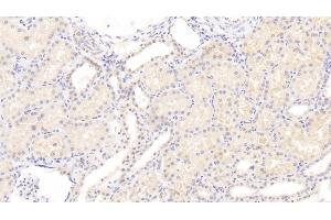 Detection of AMFR in Human Kidney Tissue using Polyclonal Antibody to Autocrine Motility Factor Receptor (AMFR) (AMFR Antikörper  (AA 456-643))
