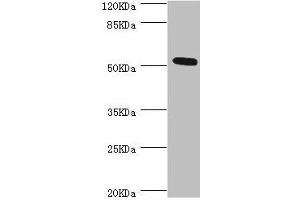Western blot All lanes: ZC3HC1 antibody at 0. (ZC3HC1 Antikörper  (AA 1-260))