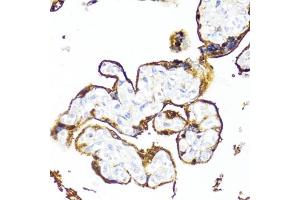 Immunohistochemistry of paraffin-embedded human placenta using HSD17B1 antibody (ABIN6129829, ABIN6142002, ABIN6142003 and ABIN6215013) at dilution of 1:100 (40x lens). (HSD17B1 Antikörper  (AA 1-328))