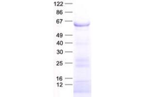 Validation with Western Blot (Keratin 2 Protein (KRT2) (His tag))