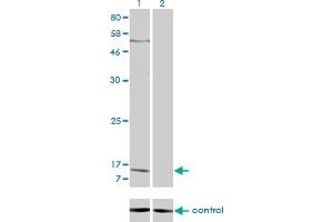 Western blot analysis of PPBP over-expressed 293 cell line, cotransfected with PPBP Validated Chimera RNAi (Lane 2) or non-transfected control (Lane 1). (CXCL7 Antikörper  (AA 37-128))