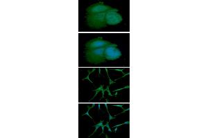 ICC/IF analysis of ARF1 in MCF7 cell line, stained with DAPI (Blue) for nucleus staining and monoclonal anti-human ARF1 antibody (1:100) with goat anti-mouse IgG-Alexa fluor 488 conjugate (Green). (ARF1 Antikörper)