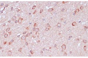 Immunohistochemistry of paraffin-embedded Rat brain using RPL32 Polyclonal Antibody at dilution of 1:100 (40x lens). (RPL32 Antikörper)