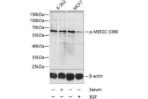 Western blot analysis of extracts of K-562 and MCF-7 cells using Phospho-MEF2C(S396) Polyclonal Antibody at dilution of 1:1000. (MEF2C Antikörper  (pSer396))