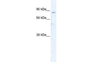 WB Suggested Anti-SIRT1 Antibody Titration:  0. (SIRT1 Antikörper  (N-Term))