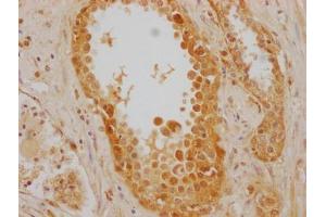 Immunohistochemistry (IHC) image for anti-Heat Shock 70kDa Protein 8 (HSPA8) (AA 2-646) antibody (ABIN7154884)