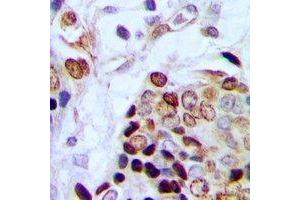 Immunohistochemistry (IHC) image for anti-TAF15 RNA Polymerase II, TATA Box Binding Protein (TBP)-Associated Factor, 68kDa (TAF15) antibody (ABIN7302774)
