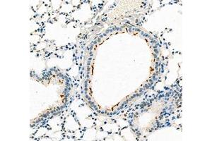 Immunohistochemistry of paraffin embedded mouse pneumonia using B3GALT4 (ABIN7073157) at dilution of 1:400 (300x lens) (ATP6V1C2 Antikörper)