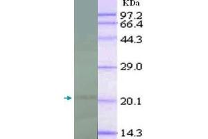 WB analysis of recombinant IL18, using IL18 antibody (1/1000 dilution).