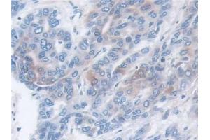 Immunohistochemistry (IHC) image for anti-Matrix Metallopeptidase 3 (Stromelysin 1, Progelatinase) (MMP3) (AA 363-477) antibody (ABIN7427837)