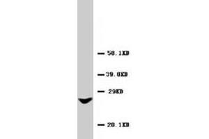 Western blot analysis of rat liver tissue lysate. (GJB2 Antikörper  (AA 1-16))