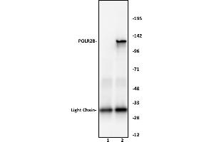 POLR2B antibody (pAb) tested by Immunoprecipitation.