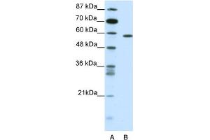 WB Suggested Anti-NR1D2 Antibody Titration:  0. (NR1D2 Antikörper  (C-Term))