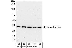 anti-Transaldolase 1 (TALDO1) (AA 267-317) antibody