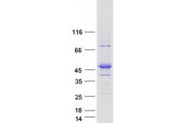 RASGEF1C Protein (Myc-DYKDDDDK Tag)
