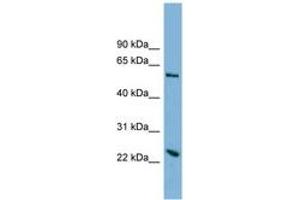 Image no. 1 for anti-Transmembrane Protein 161A (TMEM161A) (AA 179-228) antibody (ABIN6742031) (TMEM161A Antikörper  (AA 179-228))