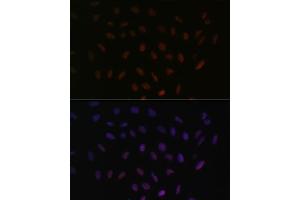 Immunofluorescence analysis of U-2 OS cells using SRSF3 antibody (ABIN6132649, ABIN6148465, ABIN6148466 and ABIN6221693) at dilution of 1:100. (SRSF3 Antikörper  (AA 1-90))
