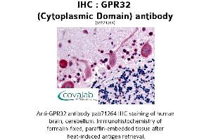 Image no. 1 for anti-G Protein-Coupled Receptor 32 (GPR32) (3rd Cytoplasmic Domain) antibody (ABIN1735060)