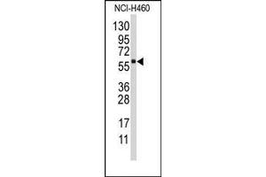 Image no. 1 for anti-Cytochrome P450, Family 4, Subfamily F, Polypeptide 12 (CYP4F12) (C-Term) antibody (ABIN360265) (CYP4F12 Antikörper  (C-Term))