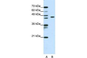 WB Suggested Anti-ZBTB9 Antibody Titration:  0. (ZBTB9 Antikörper  (N-Term))