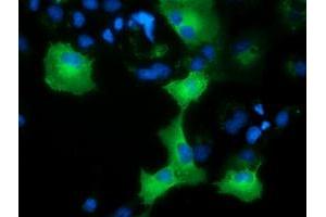 Immunofluorescence (IF) image for anti-Adenylate Kinase 5 (AK5) antibody (ABIN1496533) (Adenylate Kinase 5 Antikörper)