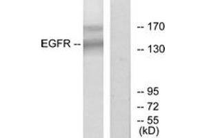 Western blot analysis of extracts from HT-29 cells, using EGFR (Ab-1172) Antibody. (EGFR Antikörper  (AA 1139-1188))