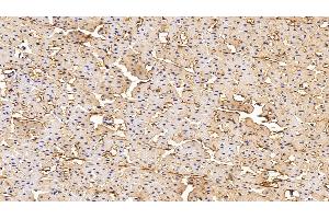 Immunohistochemistry (IHC) image for anti-Procollagen III N-Terminal Propeptide (PIIINP) antibody (ABIN7427888)