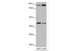 Western blot All lanes: MILR1 antibody at 14 μg/mL Lane 1: Mouse brain tissue Lane 2: HepG2 whole cell lysate Secondary Goat polyclonal to rabbit IgG at 1/10000 dilution Predicted band size: 39, 28, 29 kDa Observed band size: 39, 120 kDa (Allergin-1 Antikörper  (AA 249-343))