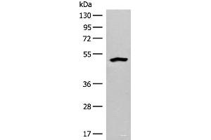 Western blot analysis of Human fetal liver tissue lysate using FBXO9 Polyclonal Antibody at dilution of 1:200 (FBXO9 Antikörper)