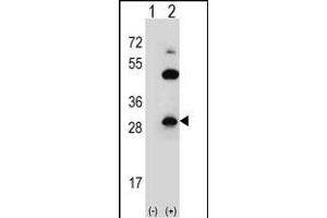 Western blot analysis of CLDN2 (arrow) using rabbit polyclonal CLDN2 Antibody  (ABIN656564 and ABIN2845824). (Claudin 2 Antikörper  (C-Term))