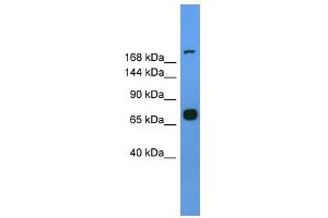 Western Blotting (WB) image for anti-Myosin Heavy Chain 7, Cardiac Muscle, beta (MYH7) (Middle Region) antibody (ABIN2776777)