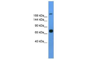 WB Suggested Anti-Myh7 Antibody Titration: 0. (MYH7 Antikörper  (Middle Region))
