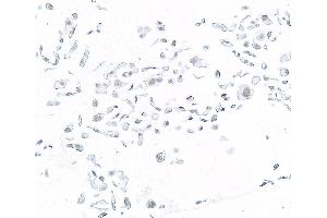 Immunocytochemistry (ICC) image for anti-SWI/SNF Related, Matrix Associated, Actin Dependent Regulator of Chromatin, Subfamily B, Member 1 (SMARCB1) (AA 225-275) antibody (ABIN7795716)