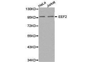 Western Blotting (WB) image for anti-Eukaryotic Translation Elongation Factor 2 (EEF2) antibody (ABIN1872437) (EEF2 Antikörper)