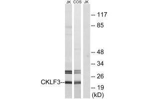 Western blot analysis of extracts from Jurkat cells and COS cells, using CKLF3 antibody.