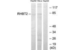 Western blot analysis of extracts from HepG2/HeLa cells, using RHBT2 Antibody. (RHOBTB2 Antikörper  (AA 61-110))