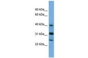 Image no. 1 for anti-Periphilin 1 (PPHLN1) (N-Term) antibody (ABIN6745665) (PPHLN1 Antikörper  (N-Term))