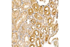 Immunohistochemistry of paraffin-embedded rat kidney using PGC1α Rabbit mAb  at dilution of 1:1000 (40x lens). (PPARGC1A Antikörper)