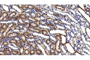 Detection of GPX1 in Rat Kidney Tissue using Polyclonal Antibody to Glutathione Peroxidase 1 (GPX1) (Glutathione Peroxidase 1 Antikörper  (AA 48-201))