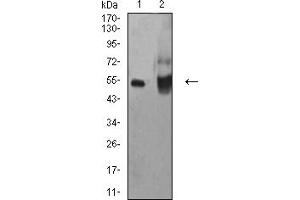 Western blot analysis using ALDH1A1 mouse mAb against HepG2 (1) and A549 (2) cell lysate. (ALDH1A1 Antikörper  (AA 1-110))