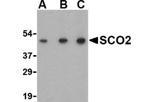 Western blot analysis of SCO2 in human liver tissue lysate with SCO2 antibody at (A) 0. (SCO2 Antikörper  (C-Term))