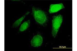 Immunofluorescence of purified MaxPab antibody to C20orf132 on HeLa cell. (C20orf132 Antikörper  (AA 1-608))