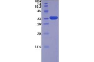 SDS-PAGE analysis of Human TRAF5 Protein.