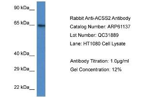 Western Blotting (WB) image for anti-Acyl-CoA Synthetase Short-Chain Family Member 2 (ACSS2) (N-Term) antibody (ABIN2788690)
