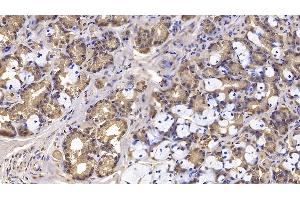 Detection of IFNb in Human Stomach Tissue using Monoclonal Antibody to Interferon Beta (IFNb) (IFNB1 Antikörper)