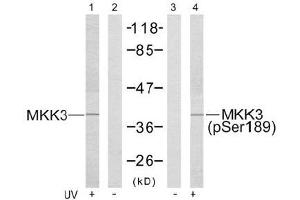 Image no. 3 for anti-Mitogen-Activated Protein Kinase Kinase 3 (MAP2K3) (pSer189) antibody (ABIN196863)