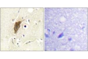 Immunohistochemistry analysis of paraffin-embedded human brain, using Myosin regulatory light chain 2 (Phospho-Ser18) Antibody. (MYL9 Antikörper  (pSer18))